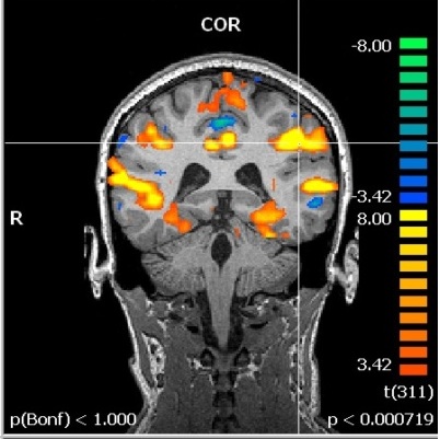Coronal for Cognition and Neuroscience